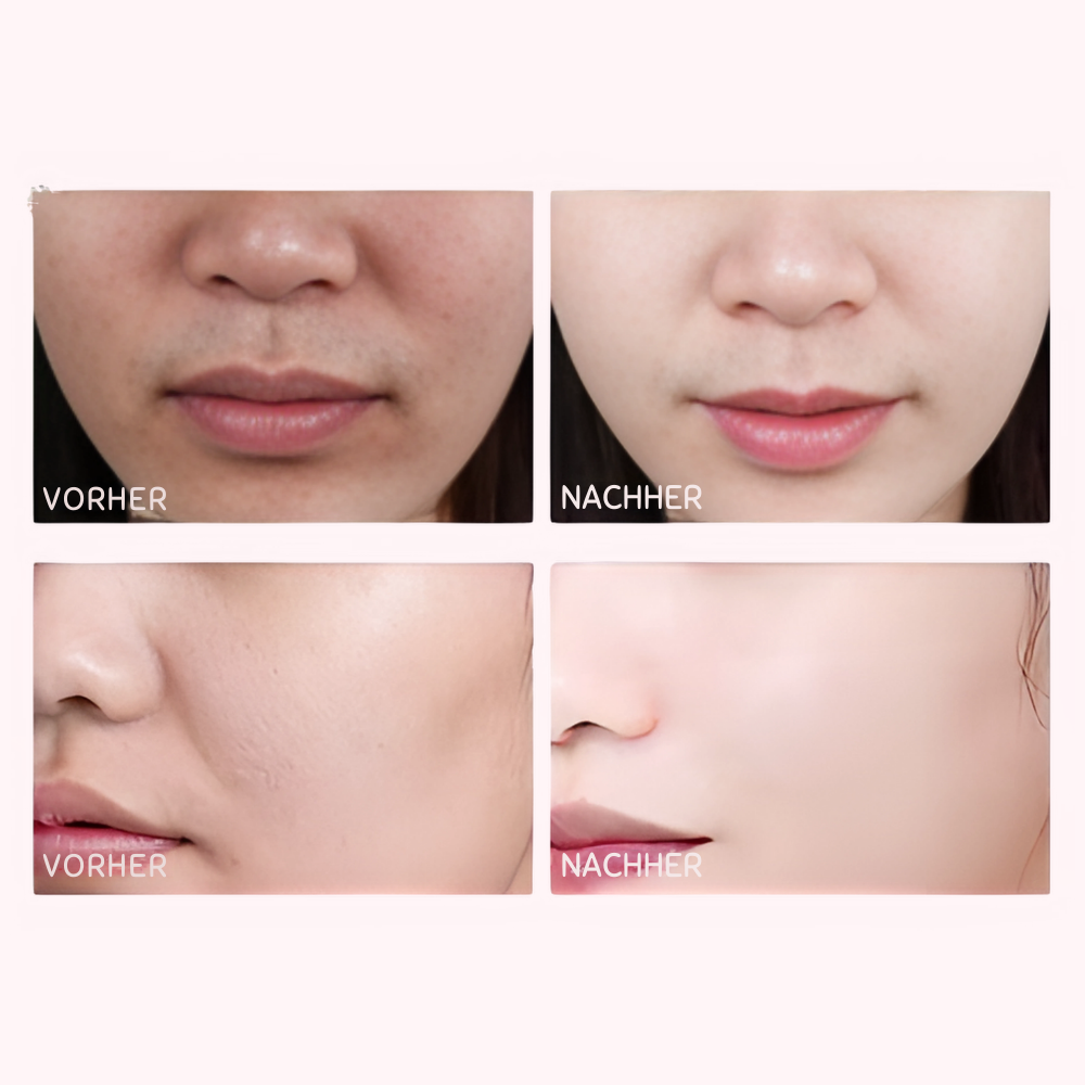 ORIZA™ RICE PEEL SHOT | DAS ORIGINAL